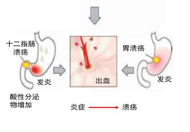 補(bǔ)硒胃炎