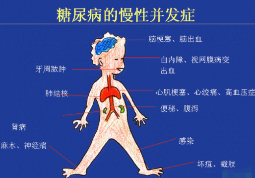 你還在害怕高血糖嗎？科學(xué)補硒不“恐糖”